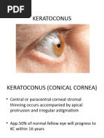 KERATOCONUS