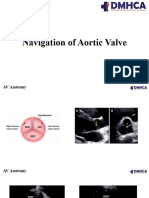 Aortic Valve