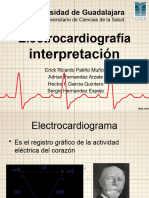 Interpretación de Electrocardiograma