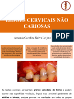 Lesoes Cervicais Nao Cariosas