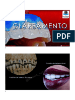 Clareamento Dental Arnaldo