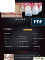 VII. Veneer