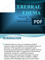 Cerebral Edema