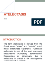 Atelectasis KSN