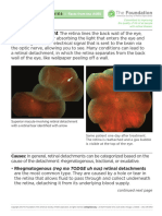 Fact Sheet 4 LP Retinal Detachment r2