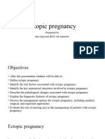 Ectopic Pregnancy