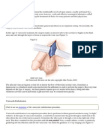 Varicocele Embolization Is Becoming The Treatment of Choice For Many Patients and Their Physicians