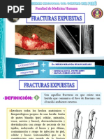 Fracturas Expuestas