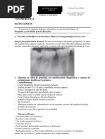 Cementoblastoma 2