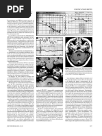 NEURINOMA