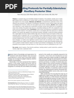 Implant Loading Protocols For Partially Edentulous Maxillary Posterior Sites