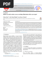 RME As An Aid To Relieve Excess Crowding: Illustration With A Case Report