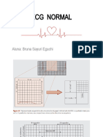 Ecg Normal