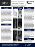 A Case of Potts Disease - Typical Presentation of An Uncommon Dis