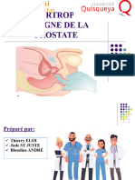 Hypertrophie Benigne de La Prostate 1