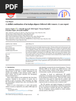 A Skillful Combination of Invisalign Aligners Followed With Veneers: A Case Report