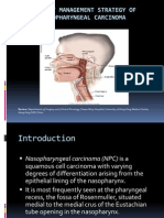 Ca Nasofaring - Nana