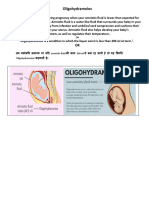 Oligohydramnios