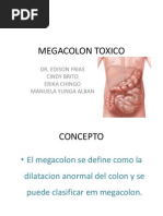 Megacolon Toxico