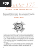 Chapter175 ExcisionofUtricular (MullerianDuct) Cyst