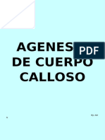 Agenesia de Cuerpo Calloso