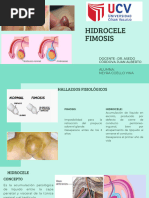 Hidrocele - Fimosis