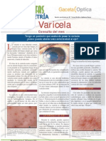 Varicela y Oftalmologia