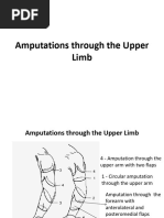 Amputations Through The Upper Limb