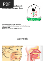 Adenoids, Acute and Chronic Tonsillitis, Chronic Sore Throat Dr. Hasan