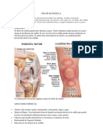 Dolor de Rodilla