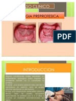 Cirugia Preprotesica