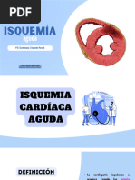 Isquemia Cardíaca Aguda