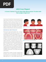 Severe Class III in Adult With Non-Surgical Approach