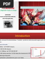 Embolie Pulmonaire: Diagnostic Et Prise en Charge