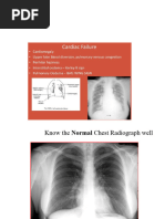 CXR Year5 Homework