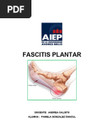 Fascitis Plantar