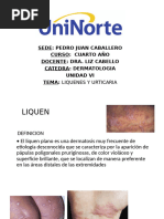 p2. Liquen y Urticaria