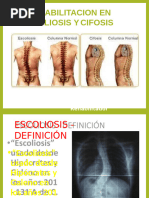 Rehabilitación en Escoliosis y Cifosis ....