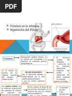 01 - Vomitos e Hipertofia Del Piloro