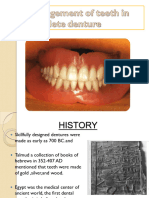 For INFO ONLY Arrangement of Teeth in Complete Denture