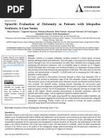 Spine3d Evaluation of Deformity in Patients With Idiopathic Scoliosis A Case Series