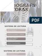 RX de torax pptx