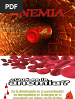 ANEMIA