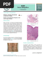 Nódulos y pápulas eritematosas en piernas y rodillas