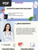 Colecistitis Aguda Por Colelitiasis