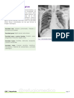 RADIOLOGIA TORAXICA