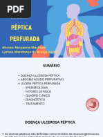 Úlcera perfurada + Questões