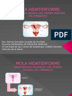 Clase de Mola Hidatidiforme 3, Hemorragia Vaginal 1er Periodo Dra. Ancheta