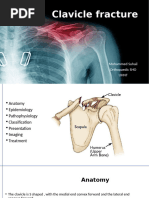 claviclefracture (1) (1)