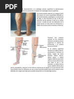 PATOLOGÍA VENOSA - DRA LIZA FLORES_241011_092219